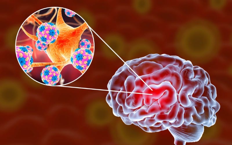 Pedido de informes sobre la situación epidemiológica de meningitis en San Luis